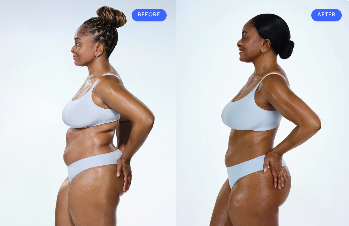Banana Roll CoolSculpting